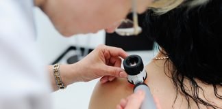 Lymph Node Removal not always Necessary for all Melanoma Patients