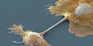 Novocure’s Optune Pax® Approved for the Treatment of Locally Advanced Pancreatic Cancer