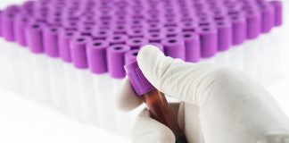 Fat Storage may make Cancer Cells more Aggressive