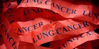 NBTXR3 (JNJ-1900) Could Offer a New Therapeutic Option for Some Lung Cancer Patients
