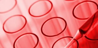 Study shows ?Nano-sensing? drives Melanoma cells? Invasion