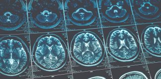 Uniting in the War on Cancer