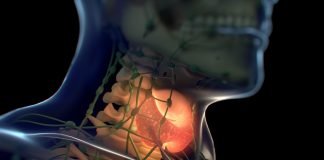Thyroid Cancer Survivors may have Elevated Risk for Aging-related Diseases