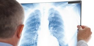 Consolidation of Phase 1 NSCLC Clinical Trial Sites in the United States: Implications for Access, Representation, and Policy