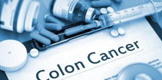 Study Results Suggest Botensilimab + Balstilimab to be a Possible Curative Therapy for Colon Cancer