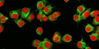 Researchers Discover an Achilles’ Heel in Neuroblastoma