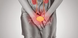 Brachytherapy for Cervical Cancer does not Increase Risk of Ureteral Stricture