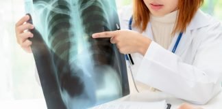 Scientists, Physicians and Patients Collaborate to Improve Treatment of EGFR-Positive Lung Cancer