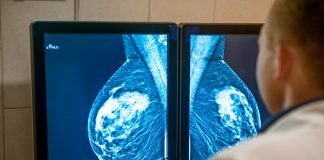 Study: Adebrelimab, Bevacizumab, and Platinum Chemotherapy Shows Promising Intracranial Activity in TNBC Brain Metastases A doctor examines mammogram snapshot of breast of patient on the monitors.