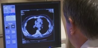 Study Identifies Previously Unrecognized Mechanism Behind Immunotherapy Resistance in Lung Cancer