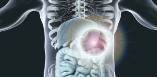 Trifluridine/tipiracil Significantly Improved Overall Survival versus Placebo in Gastric Cancer
