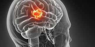 Can Cannabinoids have a Curative Impact on Glioblastoma?