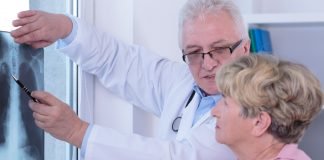 Postponing Lung Cancer Surgery More than 12 weeks after Diagnosis Associated Recurrence and Death Woman with lung cancer during medical visit