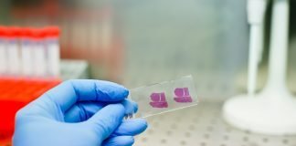 Awareness, Education and Early Detection: Best Defense in Preventing Hepatitis and Liver Cancer Handling histological liver tissue sample