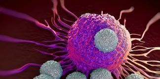CAR T-cell Therapies for the Treatment of Patients with Acute Lymphoblastic Leukemia T-cells attacking a cancer cell.