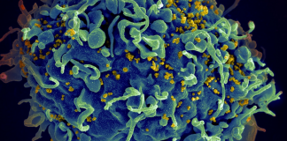 Women with HIV have Higher Prevalence of Anal High-grade Squamous Intraepithelial Lesions HIV, the AIDS virus (yellow), infecting a human cell. Photo courtesy: National Institute of Allergy and Infectious Diseases, National Institutes of Health