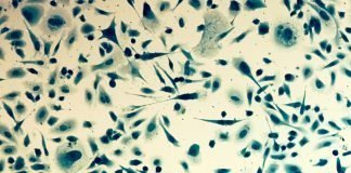 FDA Grants Priority Review for Enzalutamide in Metastatic Hormone-Sensitive Prostate Cancer Coomassie blue, under differencial interference contrast microscope.