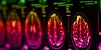 Simple Blood Test Could Lead to Better Detection of Glioblastoma