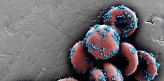 Drug-loaded Nanoparticles Bound to Circulating Red Blood Cells Inhibit Lung Cancer Metastasis Featured Image: ELECT-particles on RBCs. This scanning electron microscope (SEM) image shows drug-loaded nanoparticles bound to mouse erythrocytes (red blood cells). Photo Courtesy: Wyss Institute at Harvard University