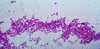 Europe Validates Application for Tepotinib for Advanced NSCLC with METex14 Skipping Alterations