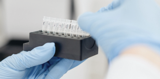 New Approach to Address the Unmet Medical Need in the Early Diagnostics for Prostate Cancer