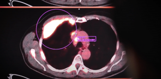 Theranostics Technology: A New Approach to Cancer Diagnosis and Treatment