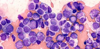 Understanding how Hibernating Cancer Evade Chemotherapy Aids Development of More Effective Drugs