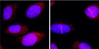 Scientists find Mechanism that Helps the Cell Survive the Damage Caused by Chemotherapy