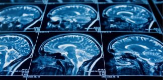 New Pathway may Enable Targeted Brain Tumor Therapy Beyond Blood-Brain Barrier