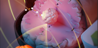 Proof-of-Concept for Novel Image-guided Magnetic Thermoseed Navigation and Tumor Ablation Therapy