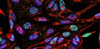 Study Provides Insights into the Genomic Basis of Cancer Metastasis