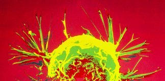 Study Shows Molecular Mechanisms that may Cause Racial Disparity in TNBC