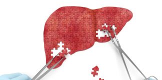 Phase 1b/2a Study Shows Positive Results for Fostrox Plus Lenvatinib in Advanced Hepatocellular Carcinoma