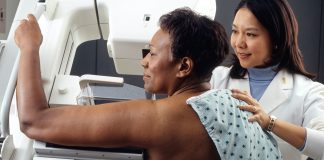 ASCO 2022: Exploring Ancestry-Specific Genetic Risk for Triple-Negative Breast Cancer
