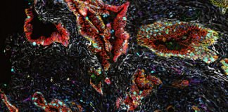 Novel Strategies in Exploring Treatment Resistance in Pancreatic Cancer