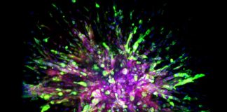 Scientists Identify a Molecular Biomarker for Cancer that Ventures Off to Form Distant Tumors
