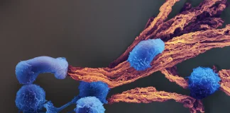 CAR T-Cell Cancer Immunotherapy Gets Personal