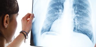 ASCO 2024: Adagrasib Shows Statistically Significant Improvement in PFS in KRASG12C-Mutated NSCLC