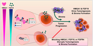 Researchers Find Potential New Treatment Option for Aggressive Pancreatic Cancer