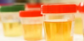Using Cutting Edge Tools to Check for Bladder Cancer