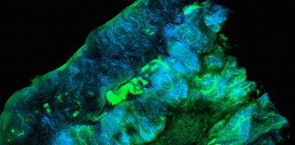 MIRASOL Trial: Elahere® Shows Survival Benefit in FRα-Positive Platinum-Resistant Ovarian Cancer