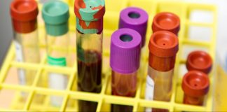 Time for Standardization: Study Investigates Blood Culture Contamination and Blood Cultures Practices in Acute Care Hospitals