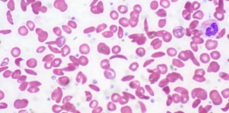 Breaking Barriers to Access: Empowering Vulnerable Populations with Cell and Gene Therapy