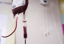 Preoperative Intravenous Iron Reduces the Need for Blood Transfusion in Colorectal Cancer Surgery
