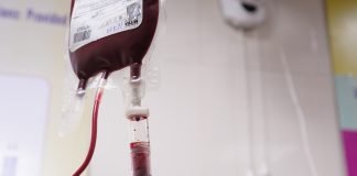 Preoperative Intravenous Iron Reduces the Need for Blood Transfusion in Colorectal Cancer Surgery