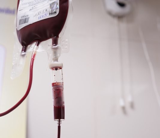 Preoperative Intravenous Iron Reduces the Need for Blood Transfusion in Colorectal Cancer Surgery