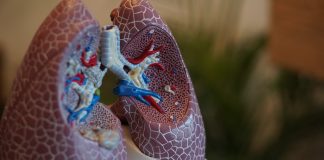 Genomic Nasal Swab Test may Improve Lung Cancer Risk Assessment for Smokers with Lung Nodules