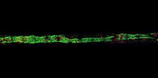 Safer cancer treatment: ‘Heart-on-a-Chip’ tests Chemotherapies and Other Cancer Drugs