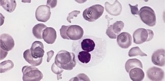 Standardizing Immunophenotyping Research Tools to Improve MDS and the Immune System