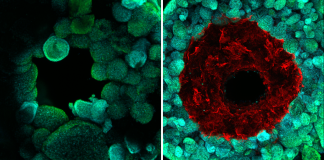 Replicating Human Vasculature: 3D-printed Blood Vessels Bring Artificial Organs Closer to Reality
